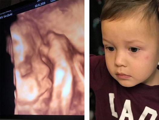 Photo from the report: Miles Family Update